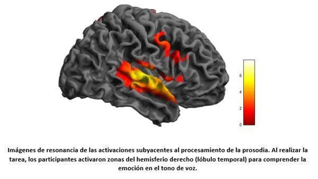 Universidad Austral encuentran signos de reorganización cerebral en epilepsia